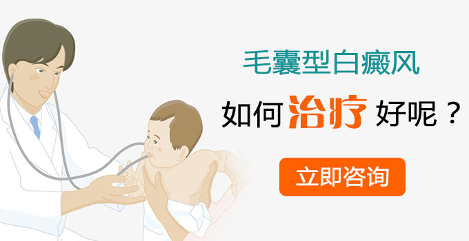 毛囊型白癜风如何治疗呢?