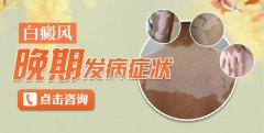 白癜风发病晚期症状有什么？