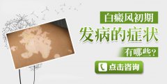 白癜风初期发病的症状有哪些？