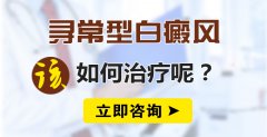 怎么治疗寻常型白癜风效果更好呢?