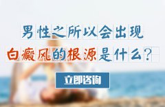 男性之所以会出现白癜风的根源是什么?