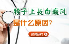 脖子上长白癜风是什么原因?